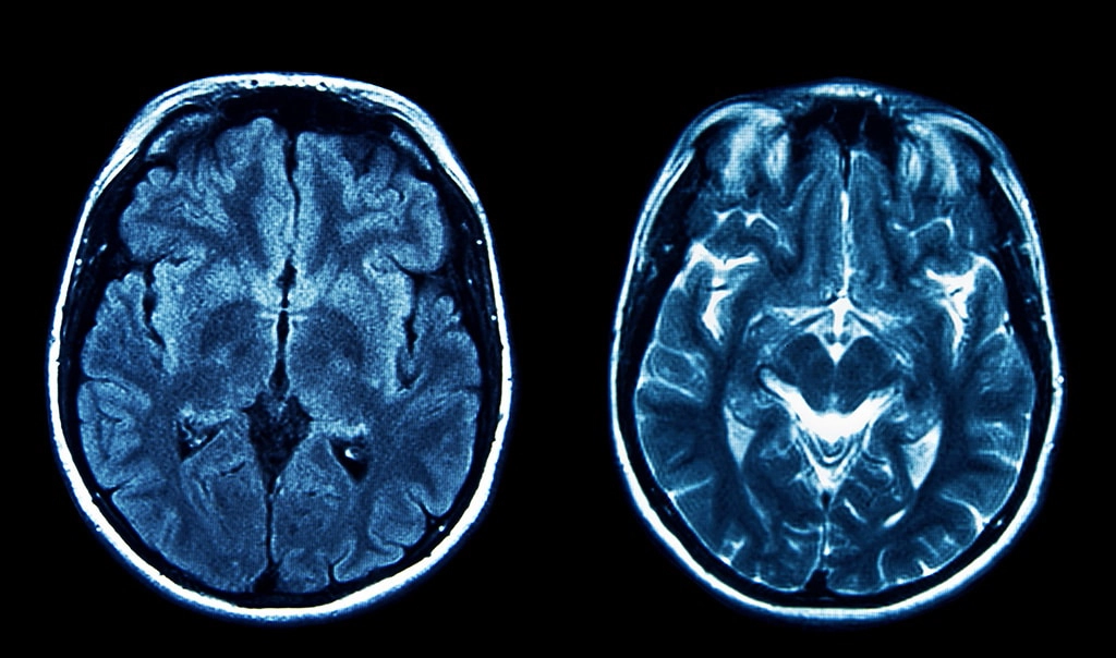 Brain Image