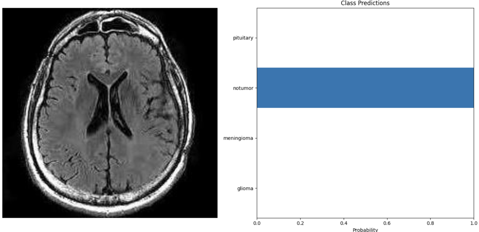 MRI Image