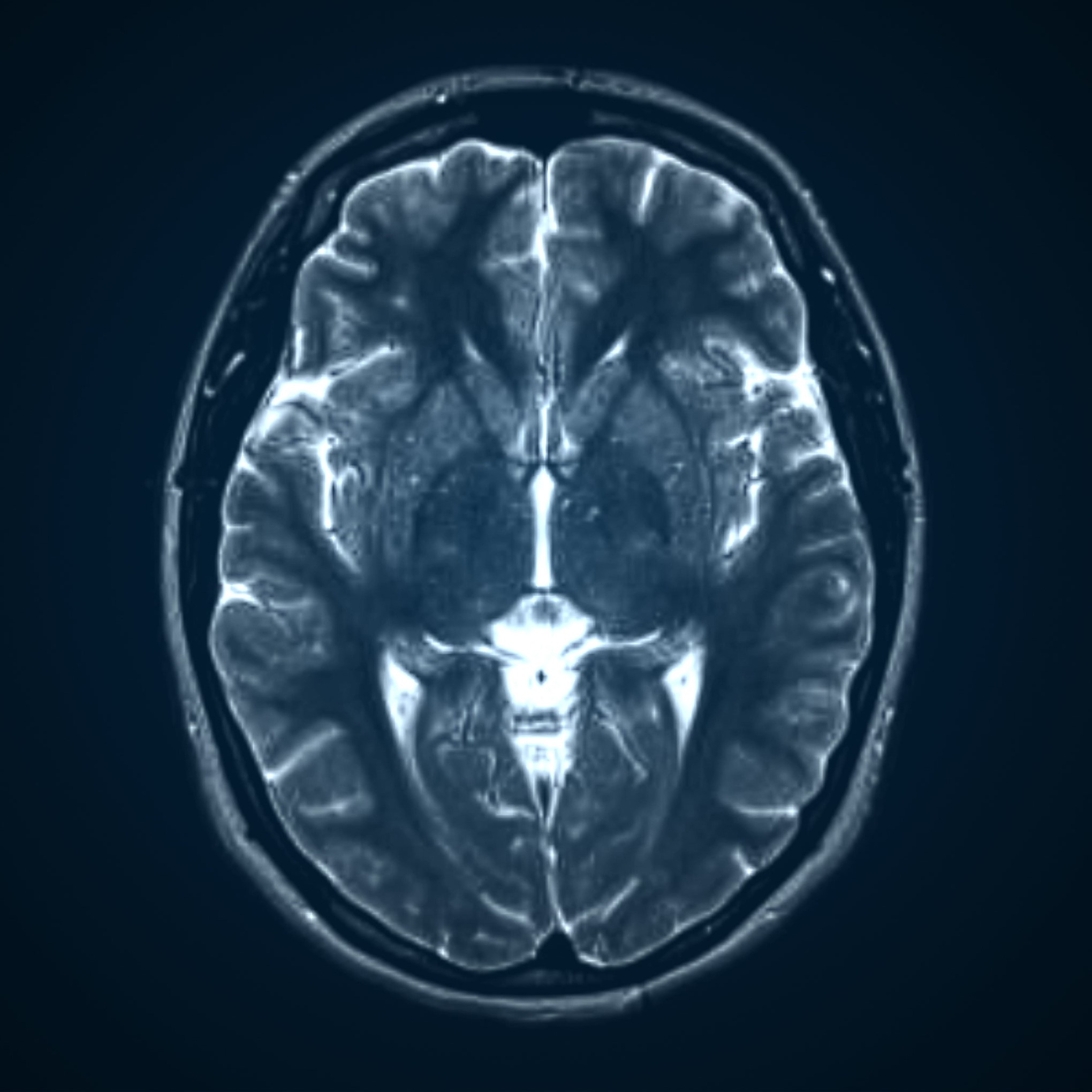 Tumor Detector